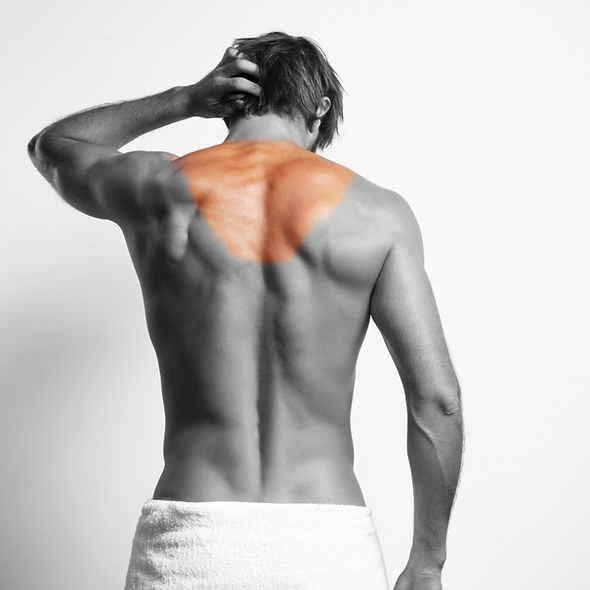 miaclinic depilacao lasr cervical.png